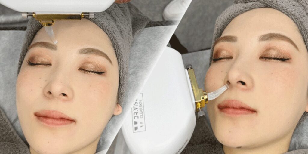 クリアスキンネオ-3